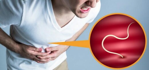 Как избавиться от паразитов