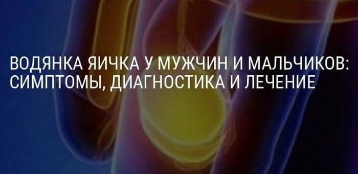 Водянка яичка (гидроцеле)